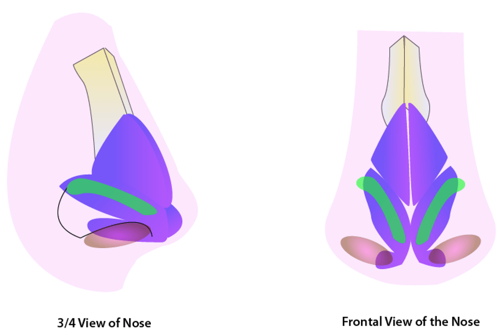 Lateral Crural Strut