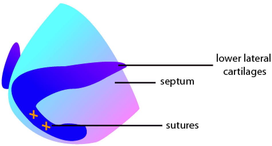 Tongue-in-Groove Technique