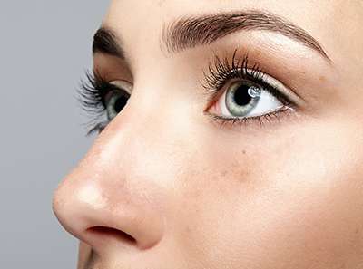 Rhinoplasty Dallas